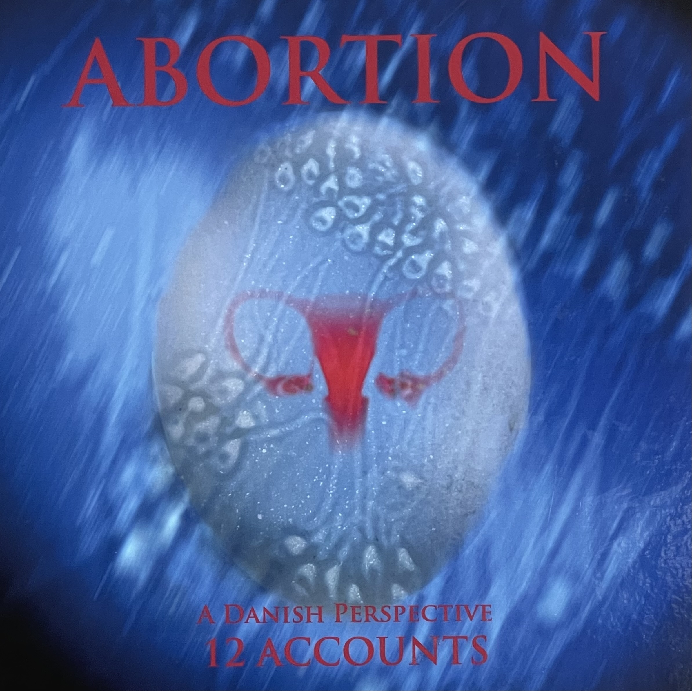 Abortion. A Danish perspective. 12 Accounts